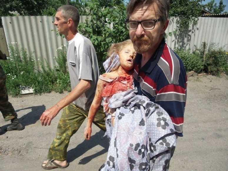 ООН ПОДСЧИТАЛИ КОЛИЧЕСТВО ПОГИБШИХ И РАНЕННЫХ МИРНЫХ ЖИТЕЛЕЙ ДОНБАССА
